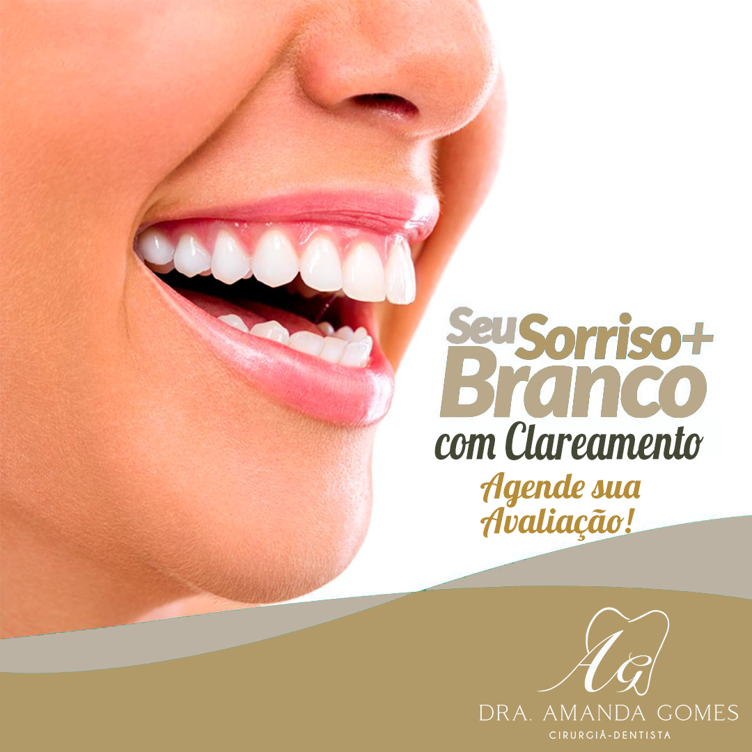 ANUNCIO-CLAREAMENTO-3-lg-bc